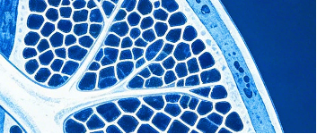 肺纤维化能吃牛羊肉吗？一文清楚饮食禁忌